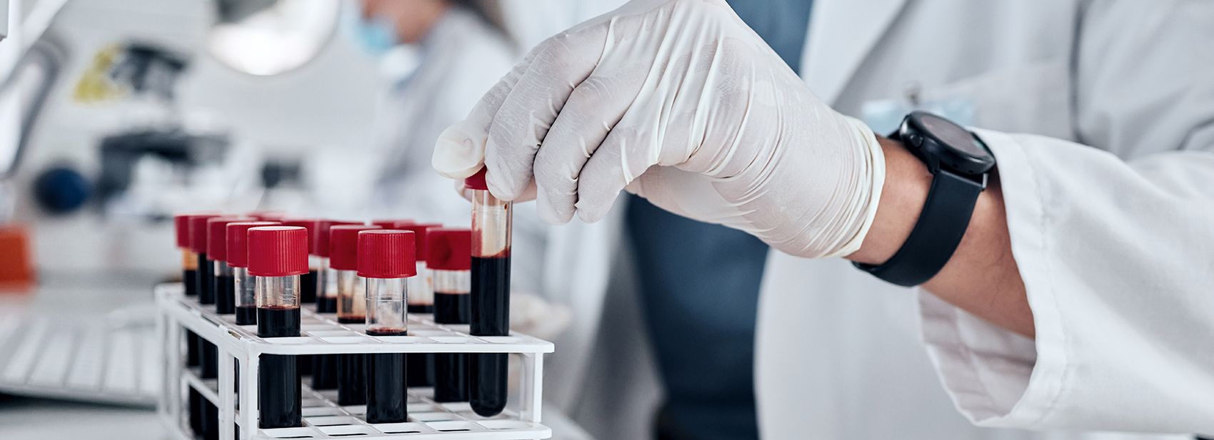 Optimizing Laboratory Staffing in the Face of Labor Shortages