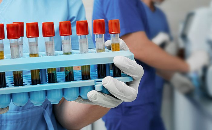  5 Steps to Increase Profitability in Hospital Labs